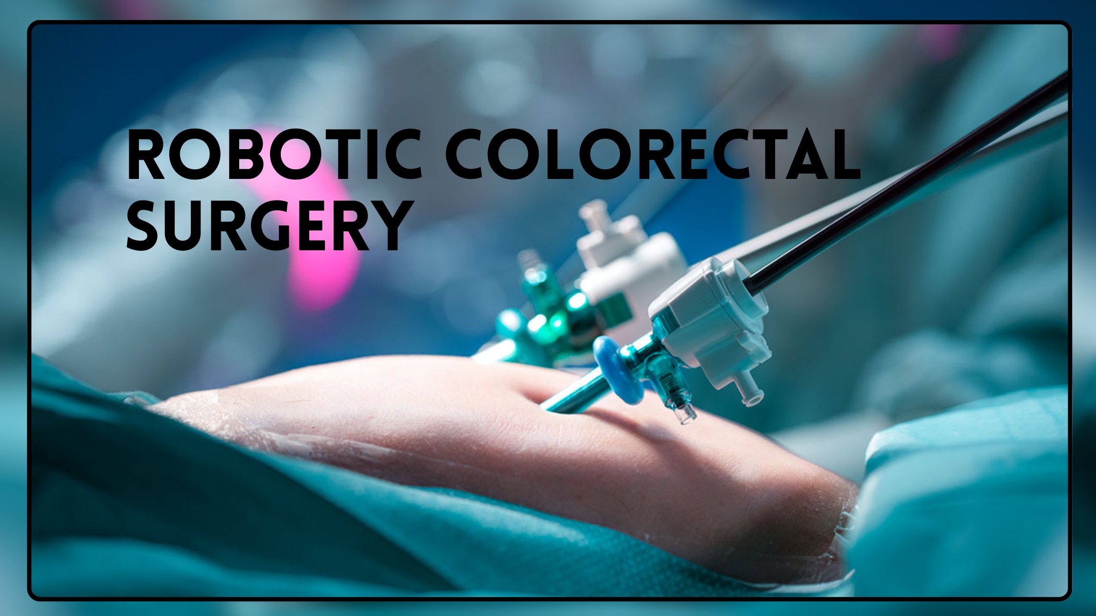 Read more about the article Robotic Colorectal Surgery- Minimally Invasive Surgical Procedure
